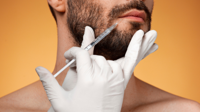 beard transplantation